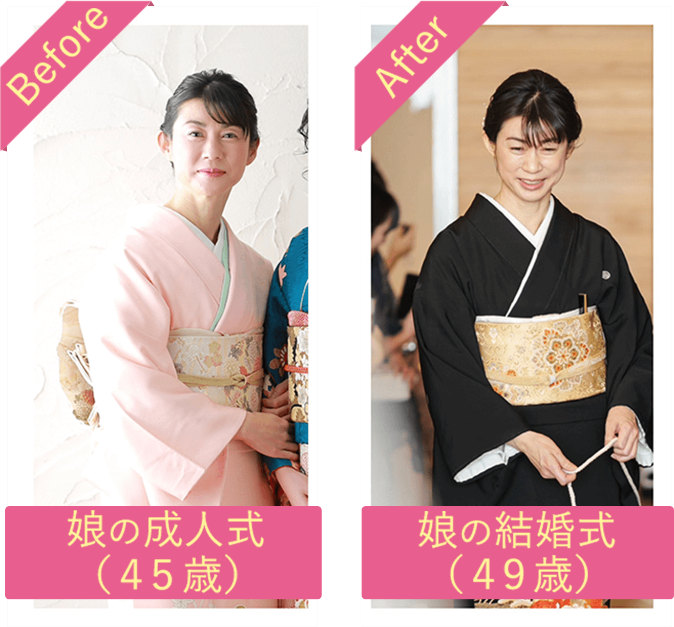 Before/After写真 Before 娘の成人式(45歳) After 娘の結婚式(49歳)