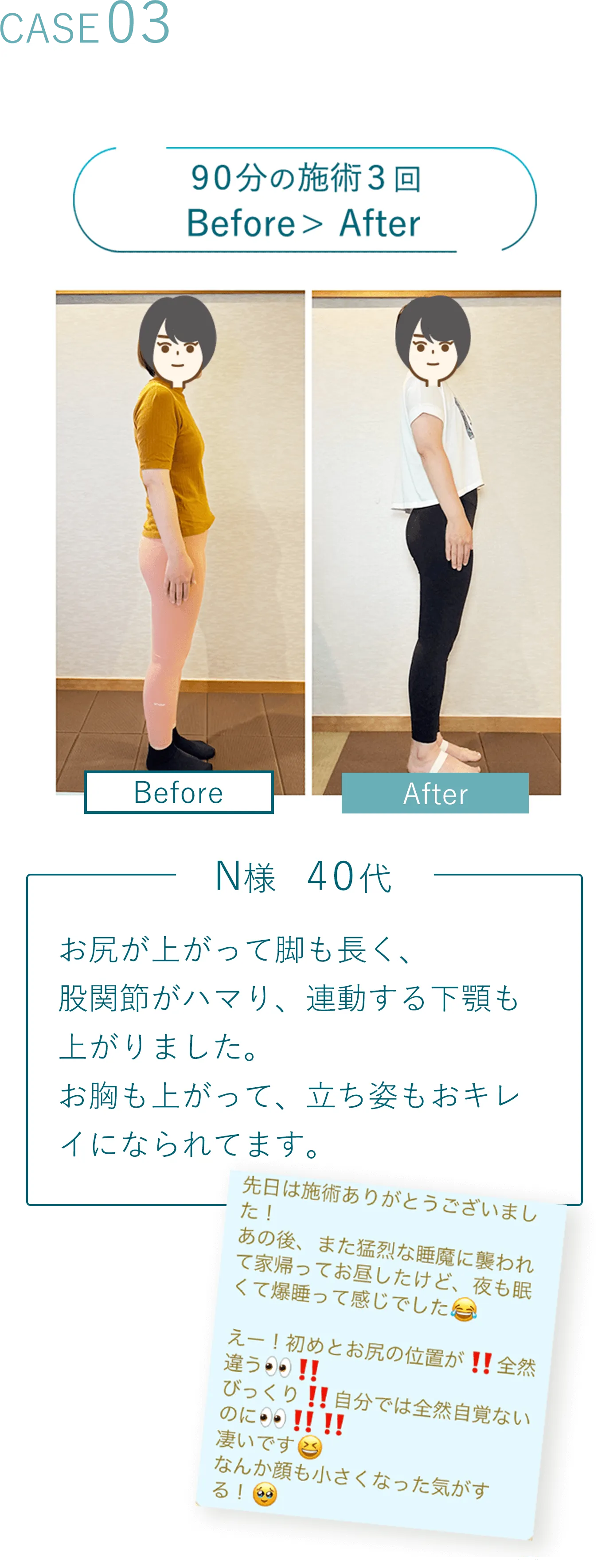 Case03 90分の施術3回 Before写真 > After写真 N様 40代 お尻が上がって脚も長く、股関節がハマり、連動する下顎も上がりました。お胸も上がって、立ち姿もおキレイになられてます。 先日はありがとうございました！あの後、また猛烈な睡魔に襲われて家帰ってお昼寝したけど、夜も眠くて爆睡って感じでした えー！初めとお尻の位置が！！全然違う！びっくり！！自分では全然自覚ないのに！！凄いです なんか顔も小さくなった気がする！